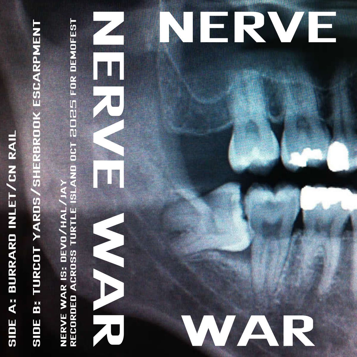 nerve war